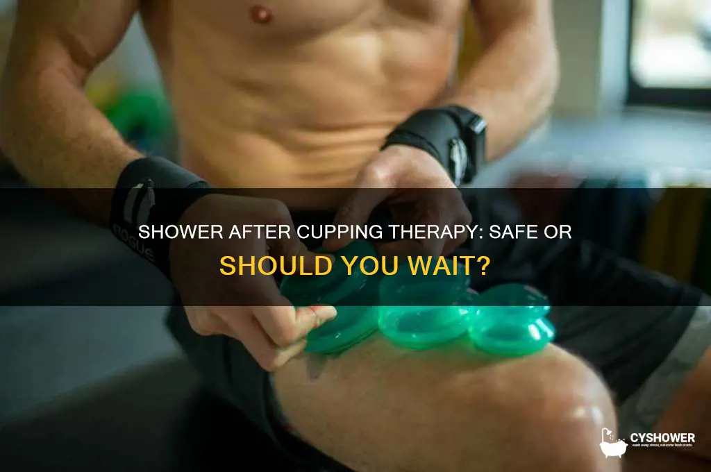 can you take shower after cupping therapy