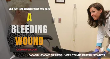 Showering with a Bleeding Wound: Safe Practices and Precautions