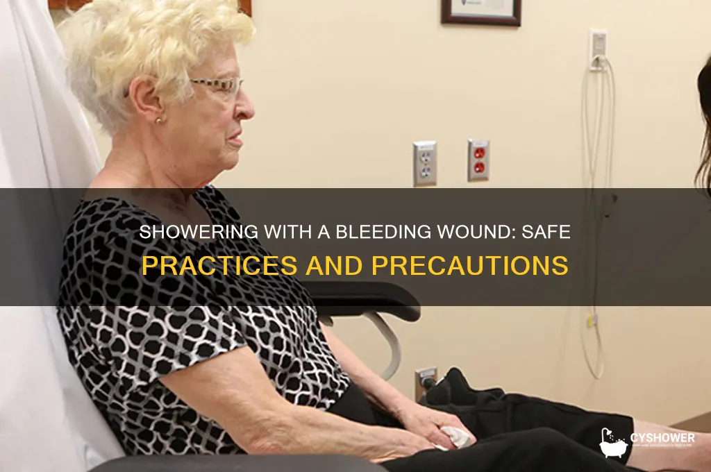 can you take shower when you have a bleeding wound