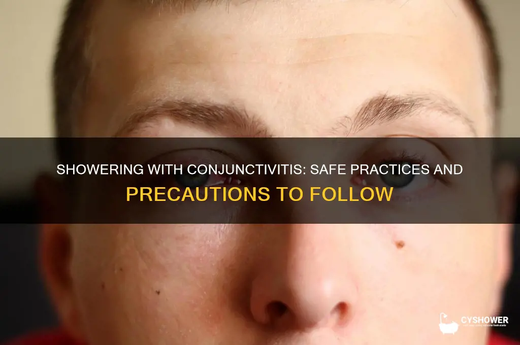 can youi take a shower with conjuctivitis