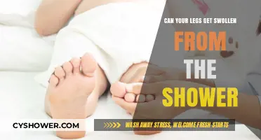 Shower Swelling: Why Your Legs Might Get Puffy After Bathing