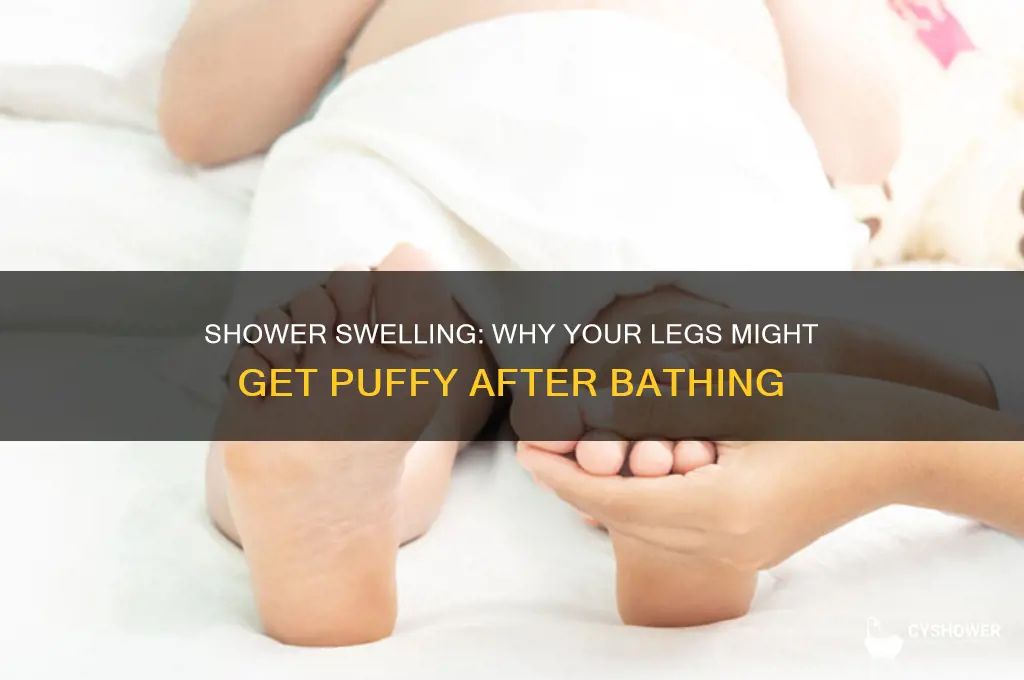 can your legs get swollen from the shower