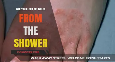 Shower Welts on Legs: Causes, Prevention, and Treatment Explained