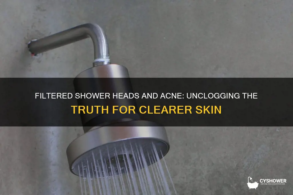 do filtered shower heads help with acne