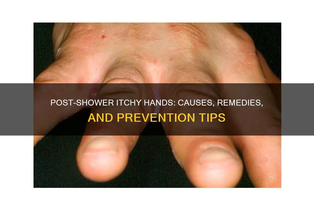 do my hands itch after i take a shower