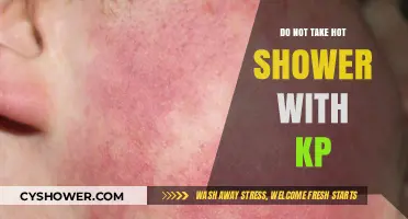 Avoid Hot Showers with KP: Protect Your Skin's Health and Comfort