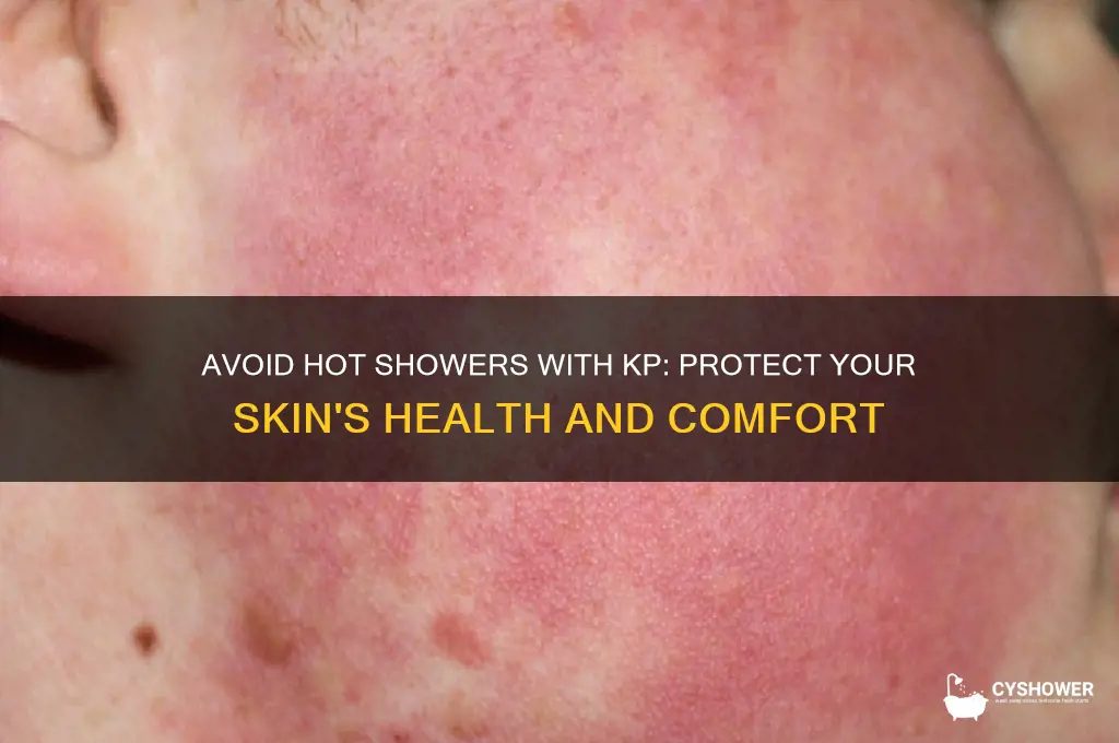 do not take hot shower with kp