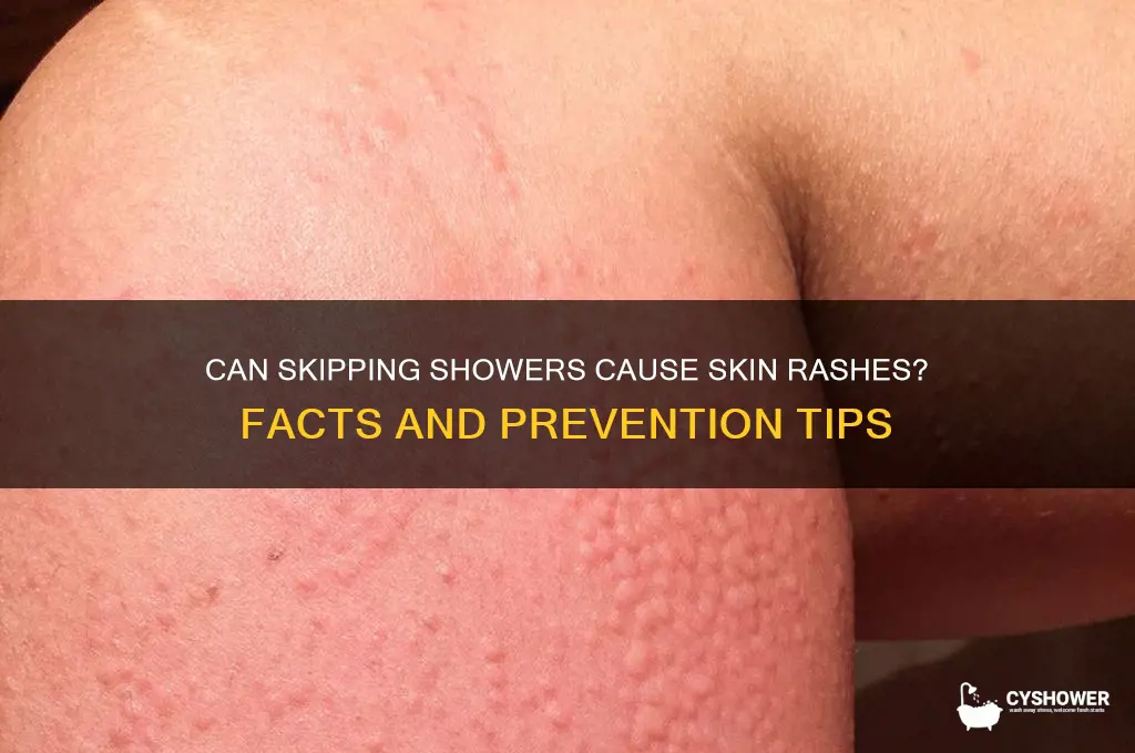 do you get skin rash if you don shower