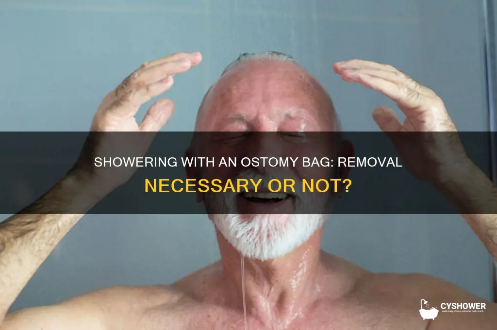do you have to remove ostomy bag for shower