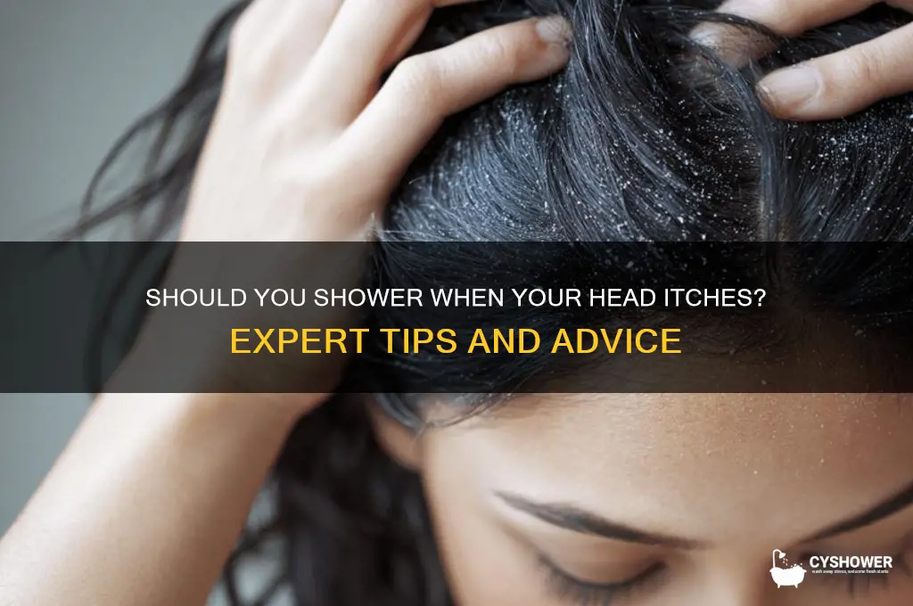 do you shower when your head itche