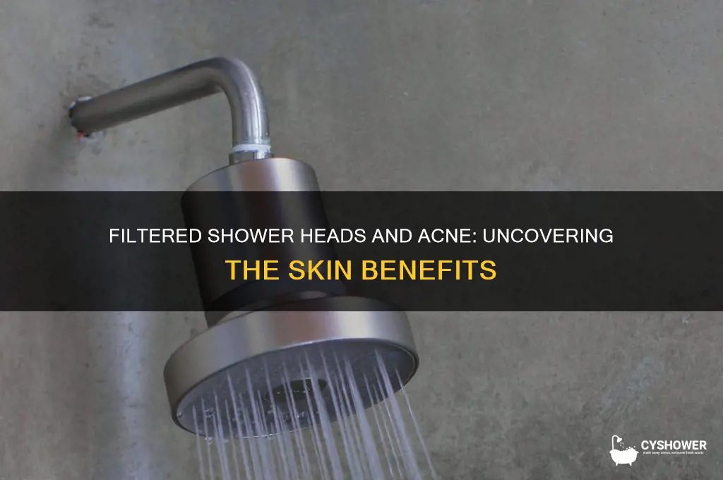 does a filtered shower head help with acne