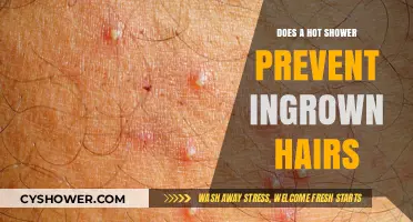 Hot Showers and Ingrown Hairs: Myth or Effective Prevention Strategy?