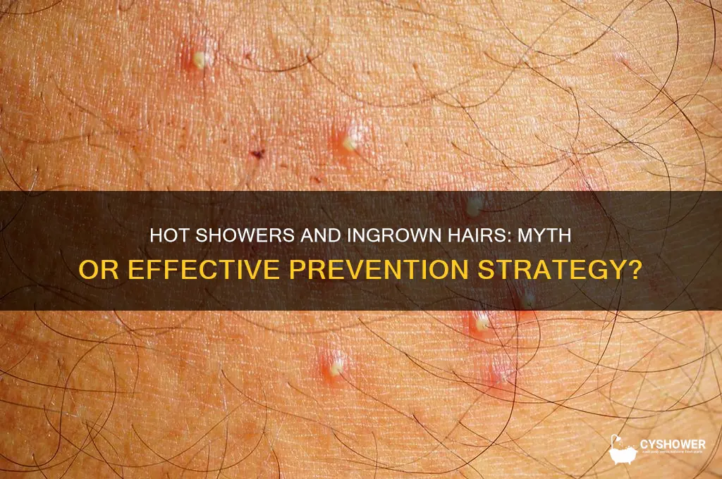 does a hot shower prevent ingrown hairs
