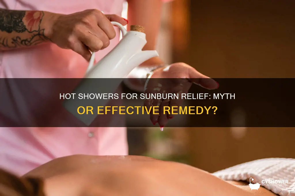 does a hot shower take away sunburn