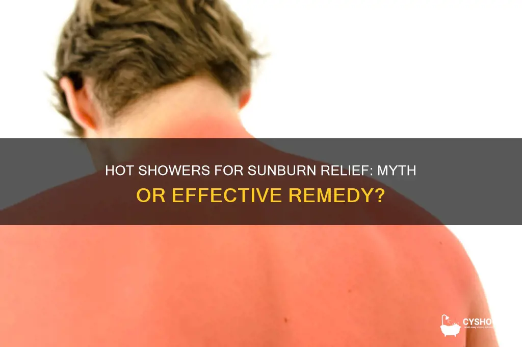 does a hot shower take the sting out of sunburn