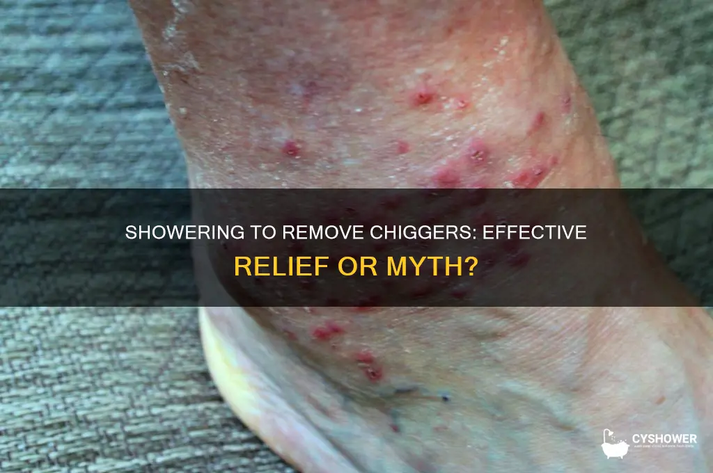 does a shower get rid of chiggers