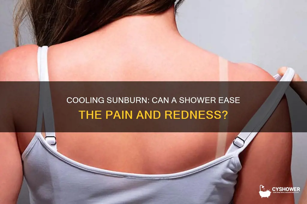 does a shower take the sting out of sunburn