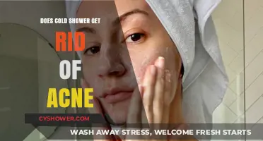 Cold Showers and Acne: Uncovering the Truth Behind the Myth