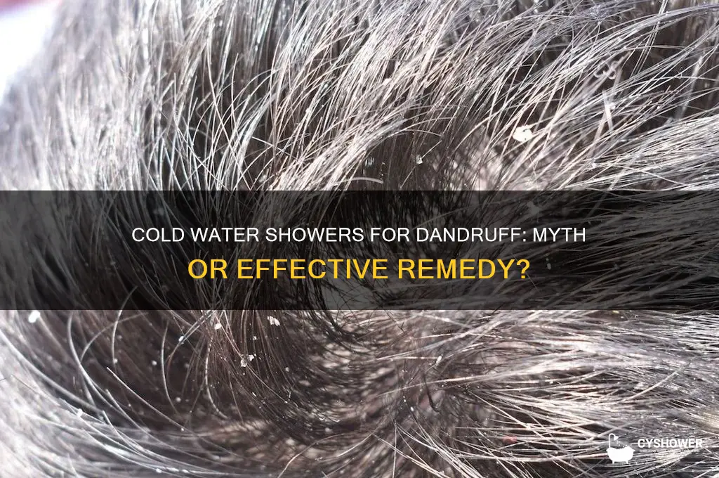 does cold water shower help dandeuff