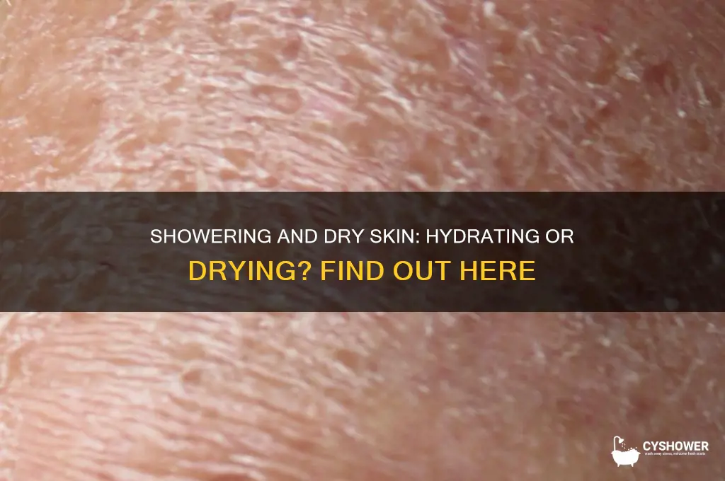 does getting a shower help with dry skin