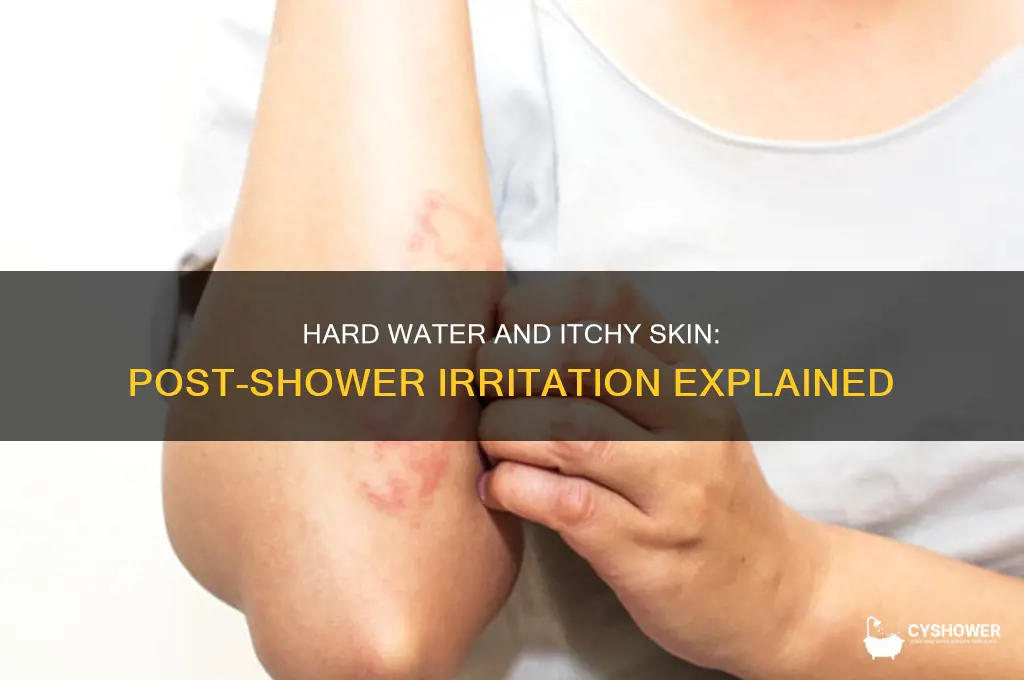 does hard water make you itch after a shower