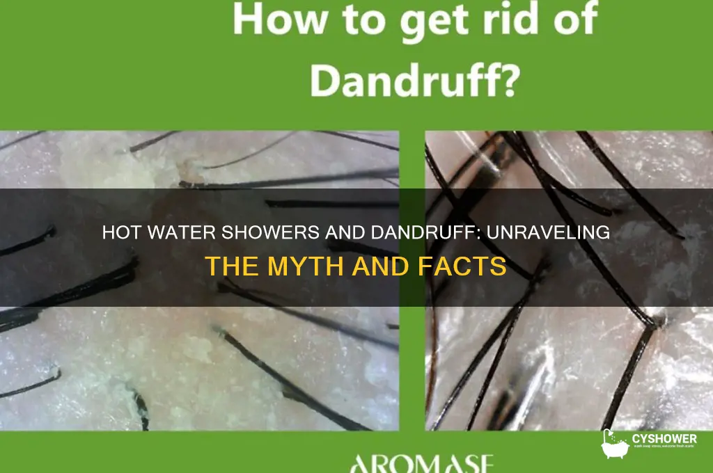 does hot water shower cause dandruff