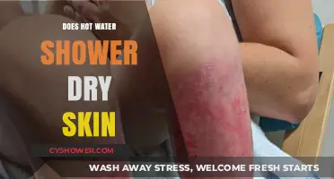 Hot Water Showers and Skin: Hydration or Dryness? Unveiling the Truth