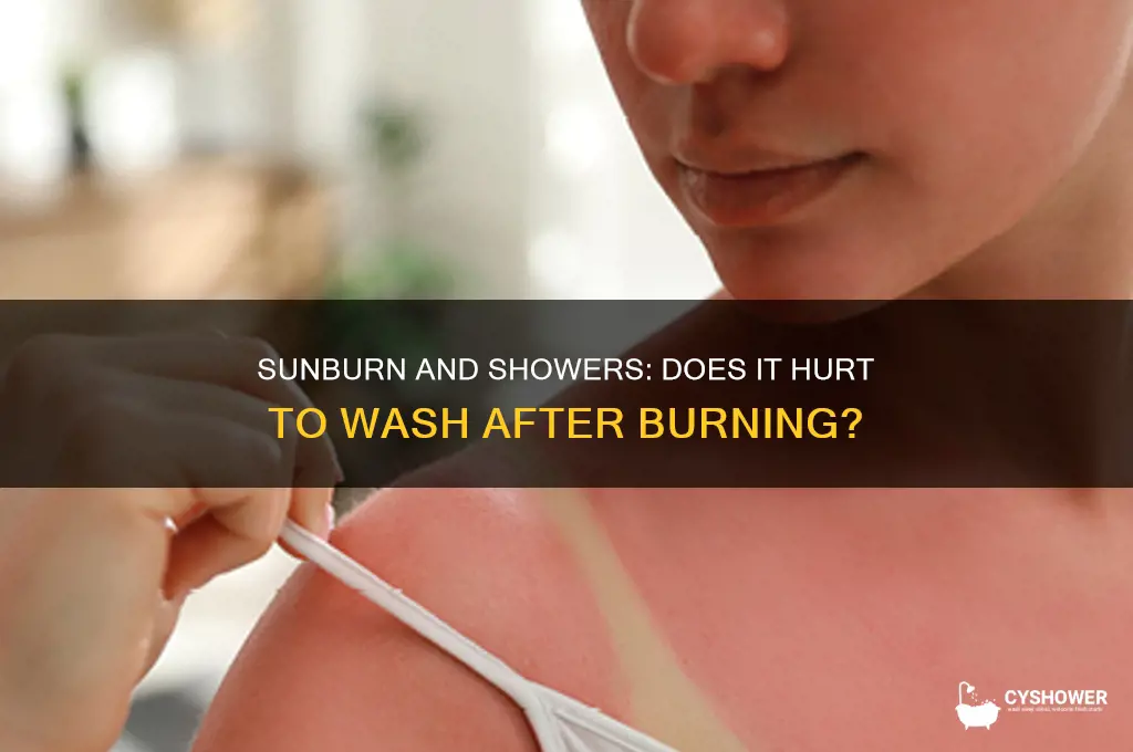 does it hurt to take a shower with a sunburn