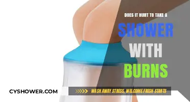 Showering with Burns: Pain, Precautions, and Healing Tips