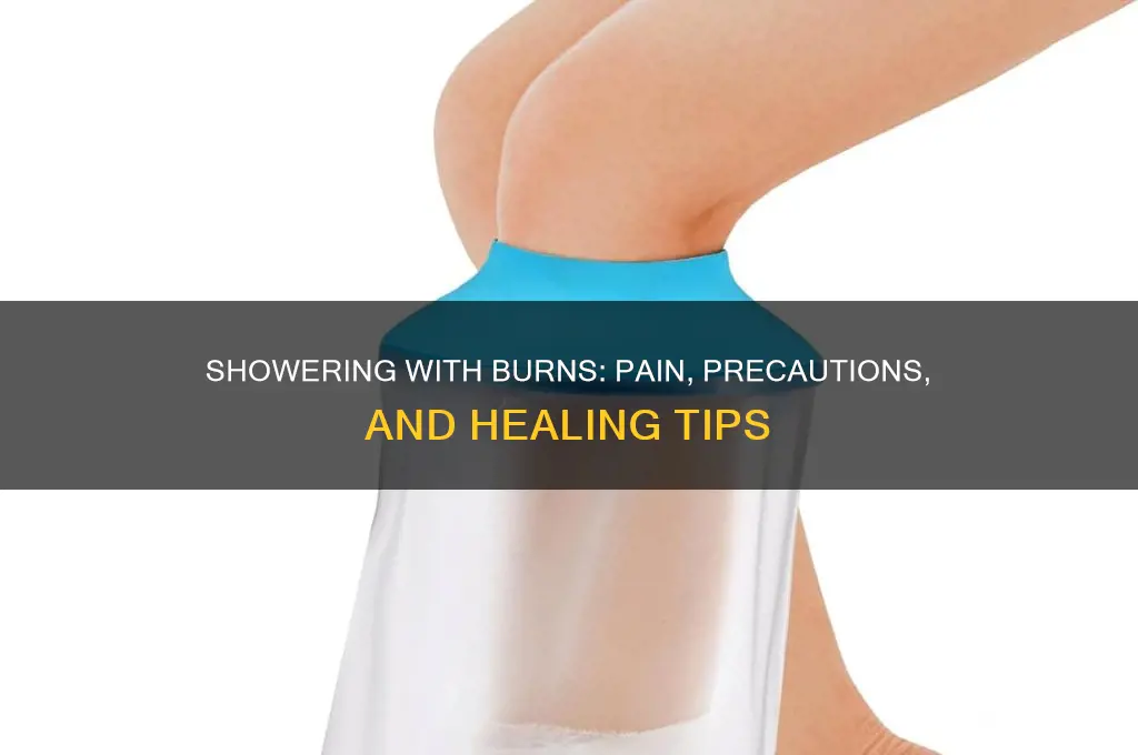 does it hurt to take a shower with burns