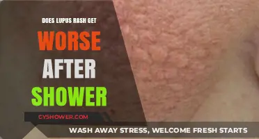 Does Lupus Rash Worsen Post-Shower? Understanding Skin Sensitivity and Care