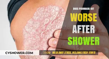 Does Psoriasis Worsen Post-Shower? Understanding Skin Reactions and Care