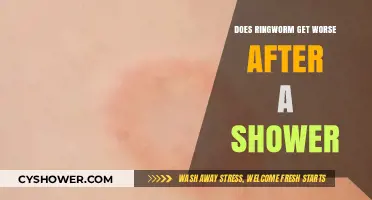 Ringworm After Shower: Does Moisture Worsen Symptoms or Aid Healing?