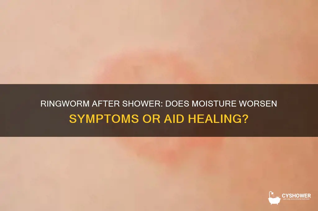 does ringworm get worse after a shower