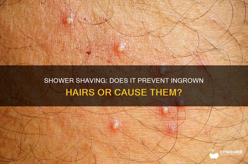 does shaving in the shower prevent ingrown hairs