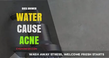 Can Shower Water Trigger Acne? Uncovering the Surprising Truth