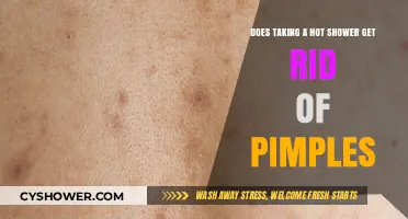 Hot Showers and Pimples: Fact or Fiction for Clear Skin?