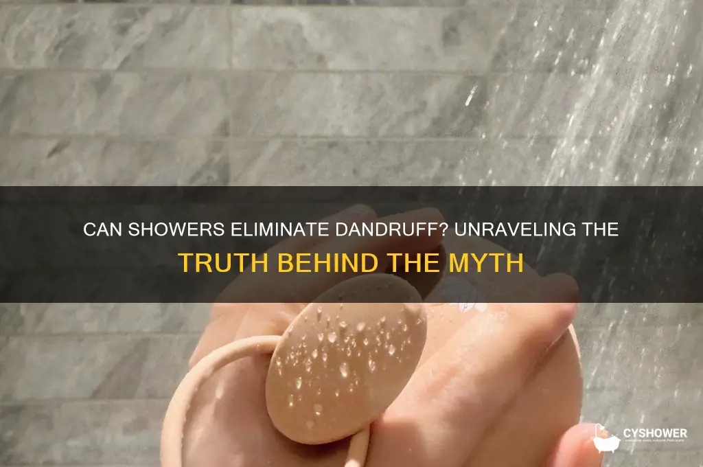 does taking a shower get rid of dandruff