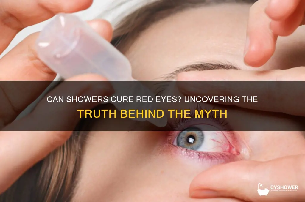 does taking a shower get rid of red eyes