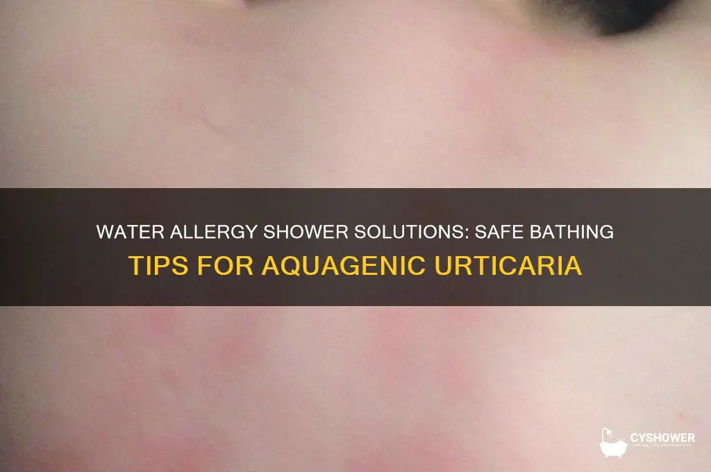 how do people allergic to water shower