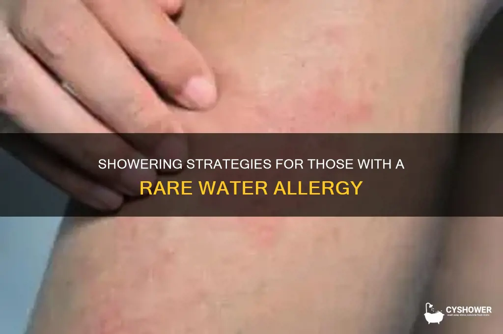 how do people with a water allergy shower