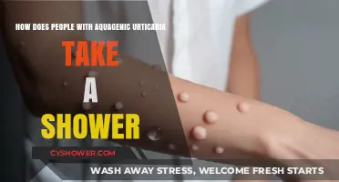 Showering Strategies for Aquagenic Urticaria: Tips for Managing Water Allergies
