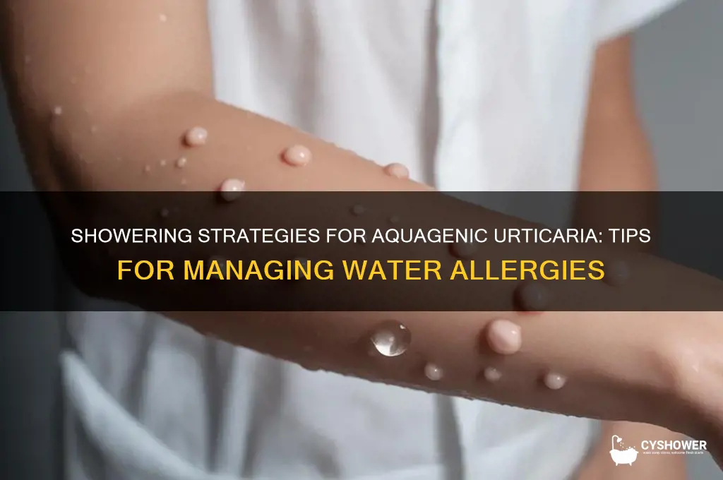 how does people with aquagenic urticaria take a shower