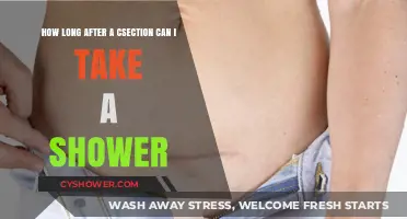 Post-C-Section Shower Guide: When It’s Safe to Freshen Up