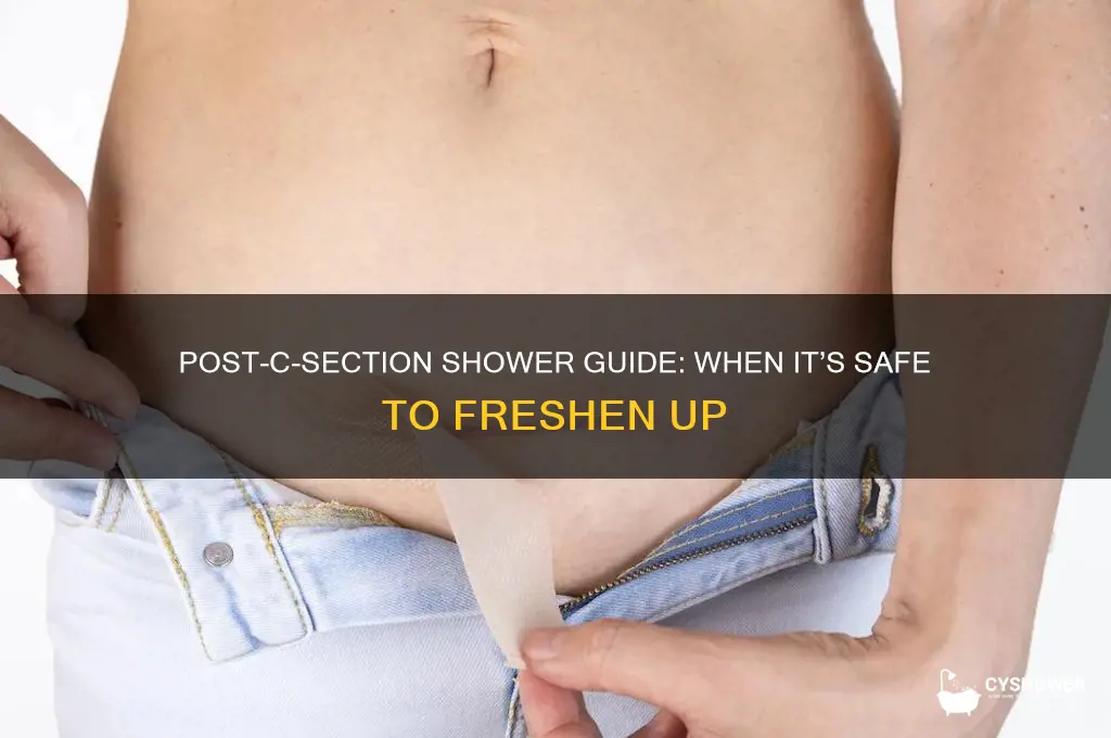 how long after a csection can i take a shower