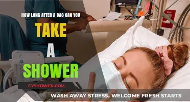 Post-D&C Shower Guidelines: When Can You Safely Shower Again?
