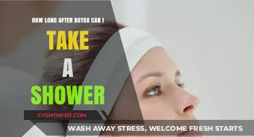 Post-Botox Shower Guidelines: When Can You Safely Get Wet?