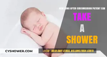 Post-Circumcision Shower Guidelines: When Can Patients Safely Shower Again?