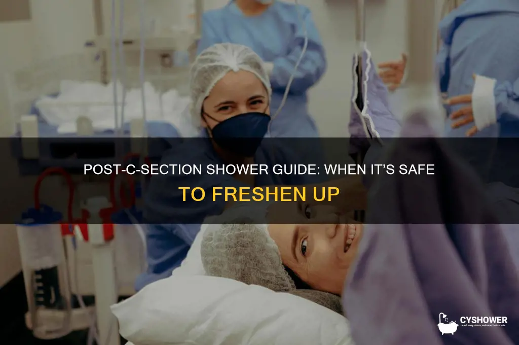 how long after csection can i take a shower