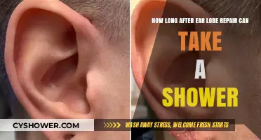 Ear Lobe Repair Recovery: When Can You Shower Again?